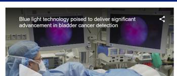 Fox 11 News Los Angeles  Features Blue Light Cystoscopy