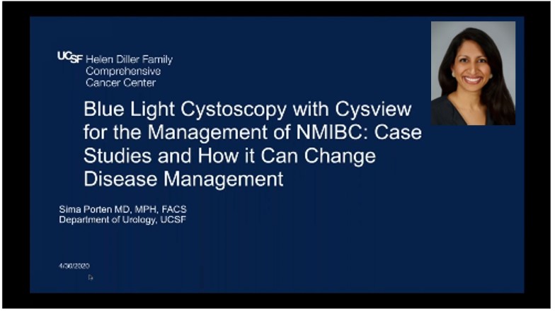 Bladder cancer expert Schuckman discusses Blue Light Cystoscopy with Cysview for bladder cancer diagnosis.