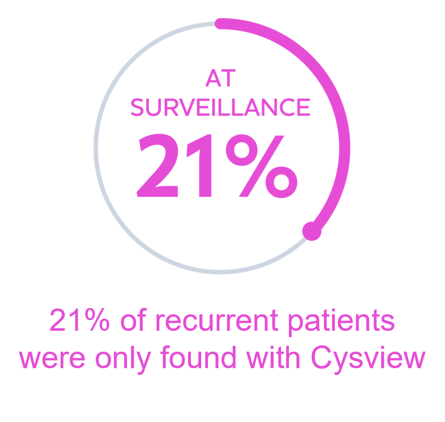 Cysview makes bladder cancer tumors glow bright pink so more can be seen during cystoscopy in surveillance